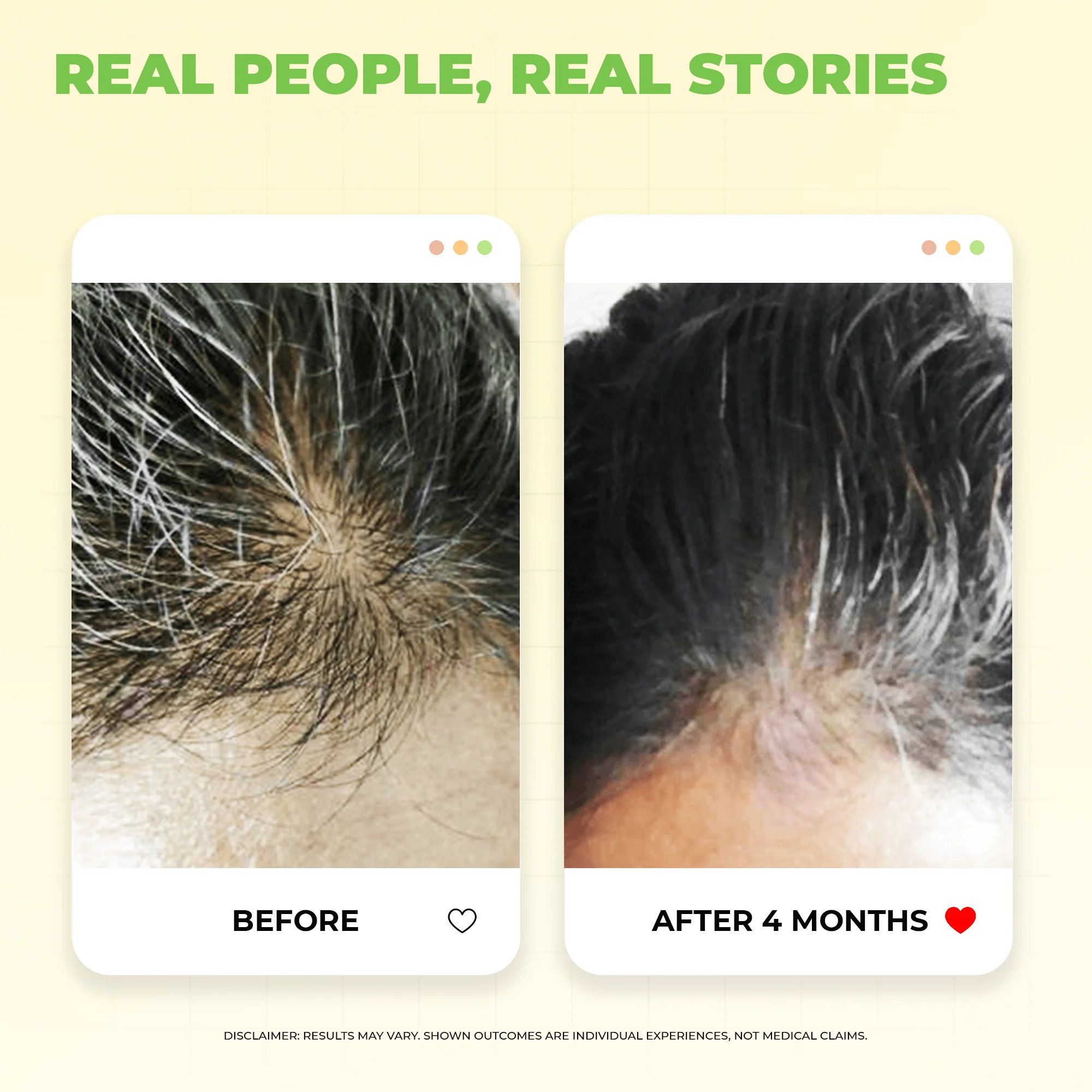 Scalptone Grey Hair Serum - Image 4