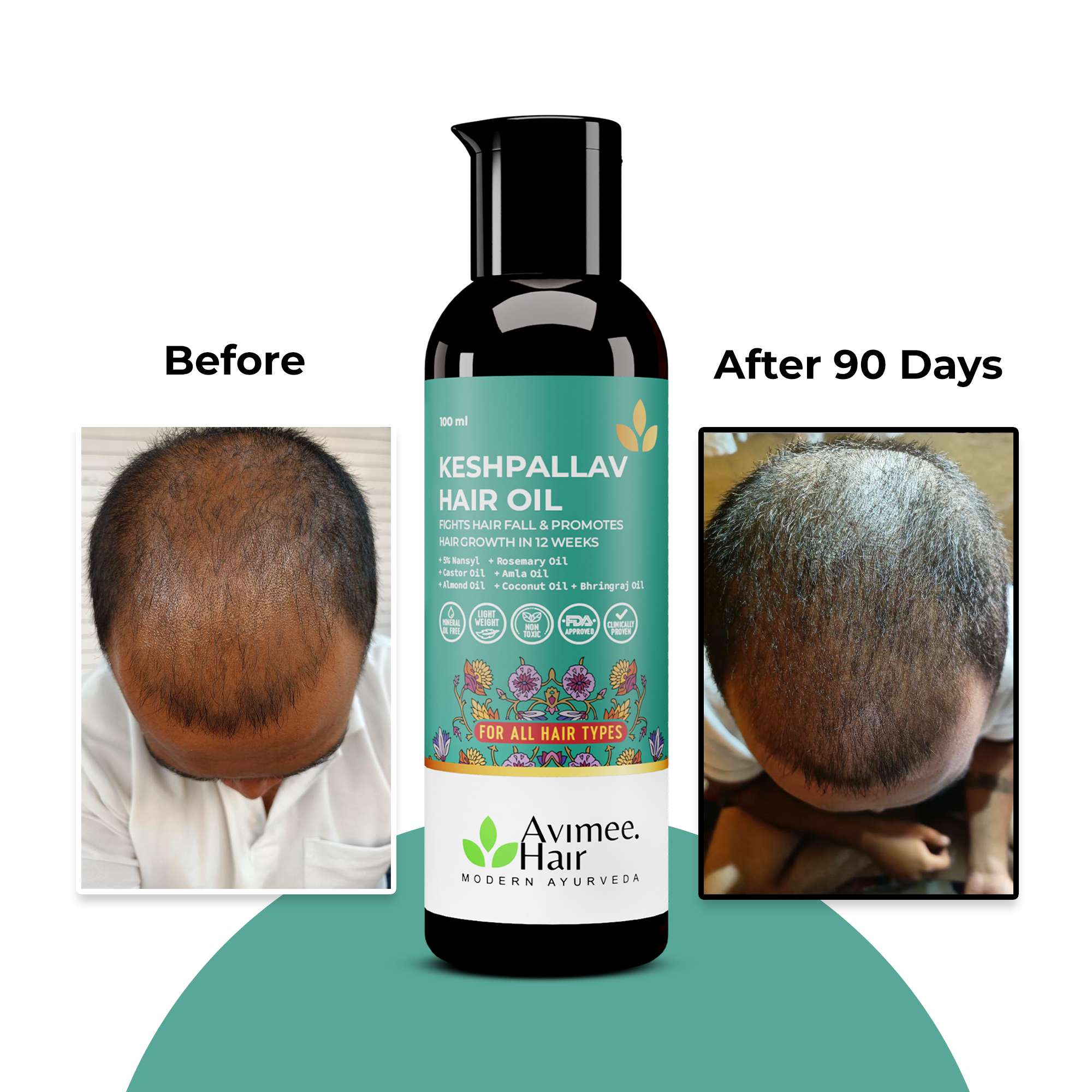 DHT Blocker Hair Growth Kit (Mini) for Male Pattern Baldness - Image 10