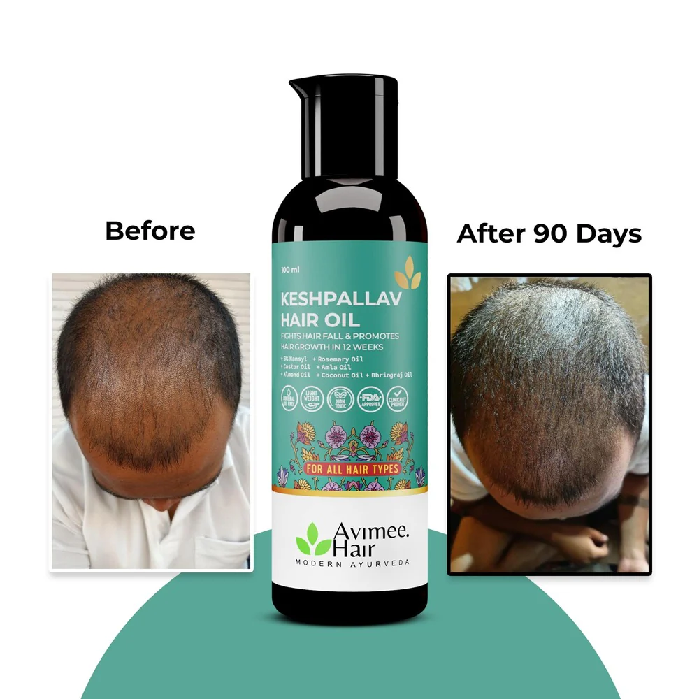 DHT Blocker Kit+ for Pattern Baldness - Image 12