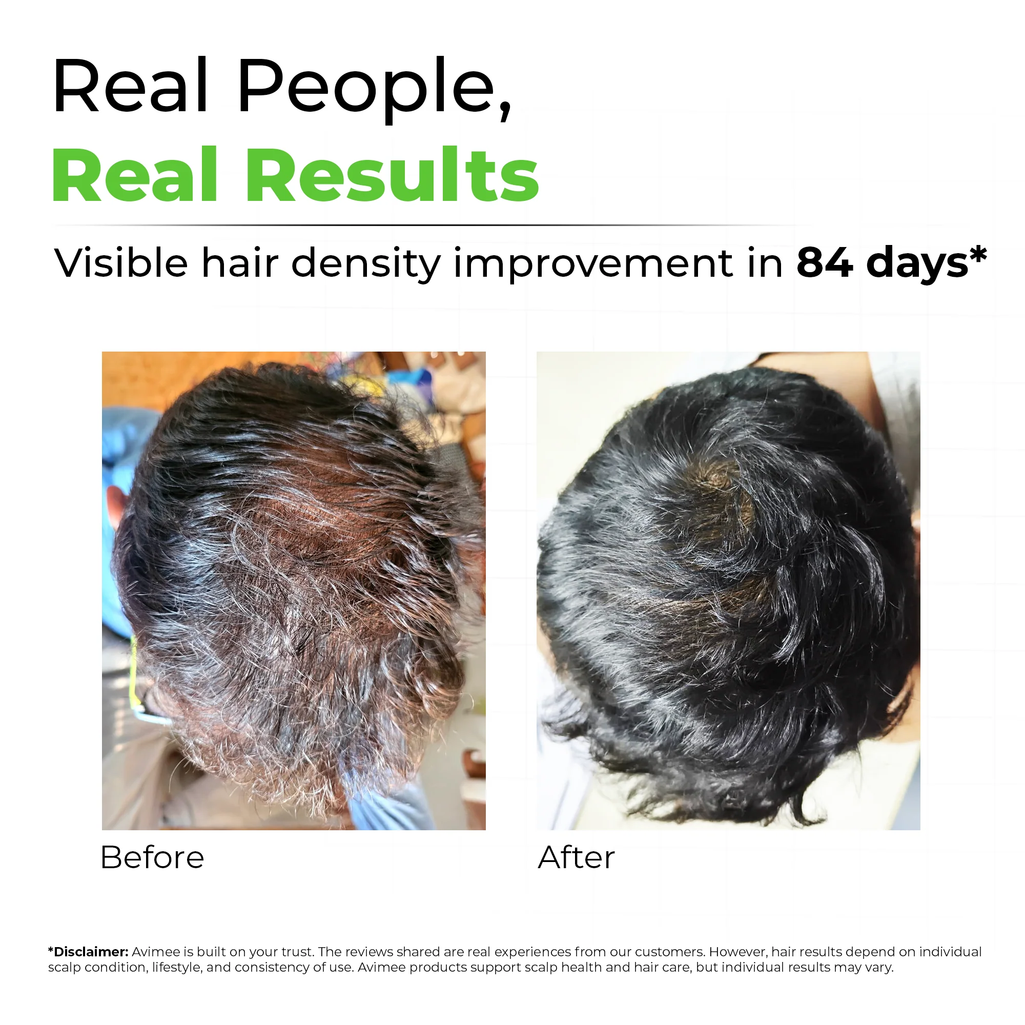 Rosemary Water for Hair and Skin - Image 3